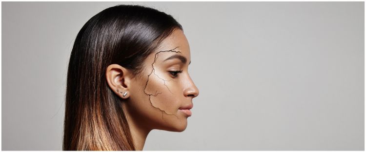 Rutin Skincare Untuk Kulit Kering & Mengelupas - 10 Langkah untuk Mengembirikan Kulit Anda