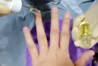 Kulit Menipis: Punca dan Pemulihan Selamat